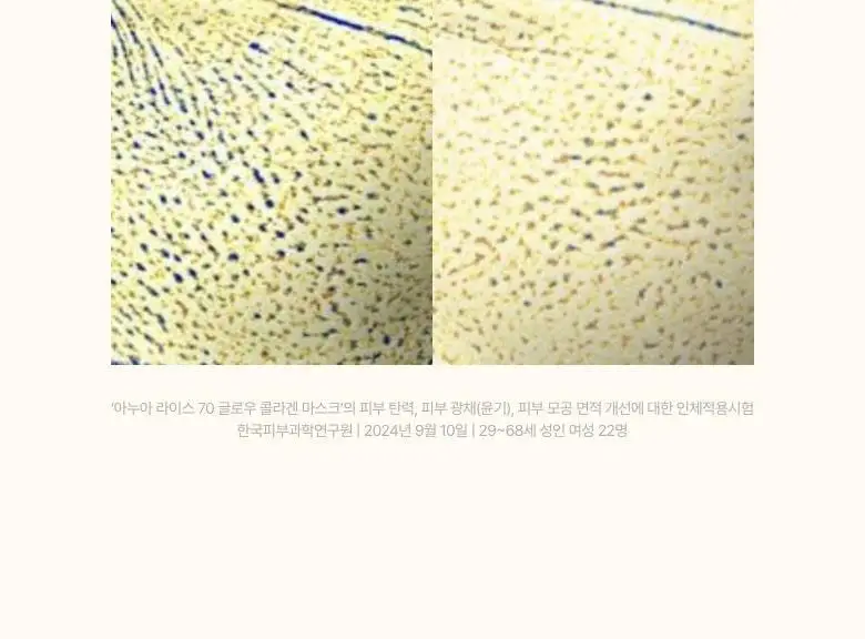 [탄력케어] 아누아 콜라겐 마스크 4매 3종(어성초/복숭아/라이스) 상세페이지 75